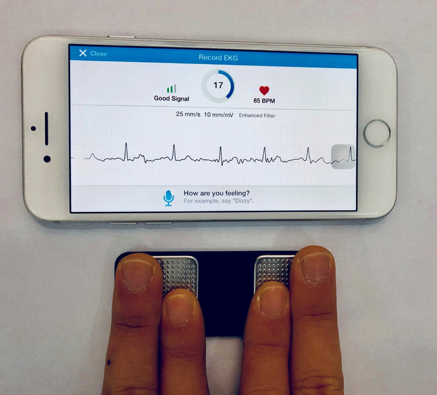 Single-lead ECG device